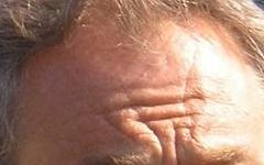 tony-blair forehead